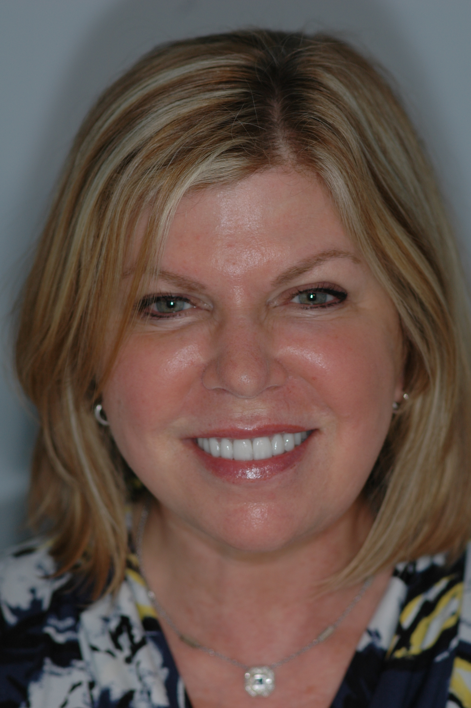 Heidi - Patient Care Coordinator