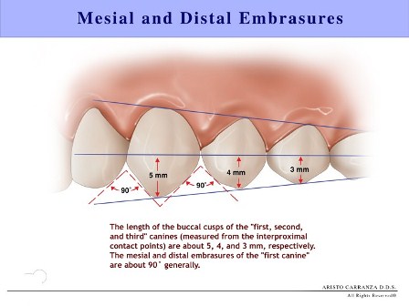Smile design embrasures