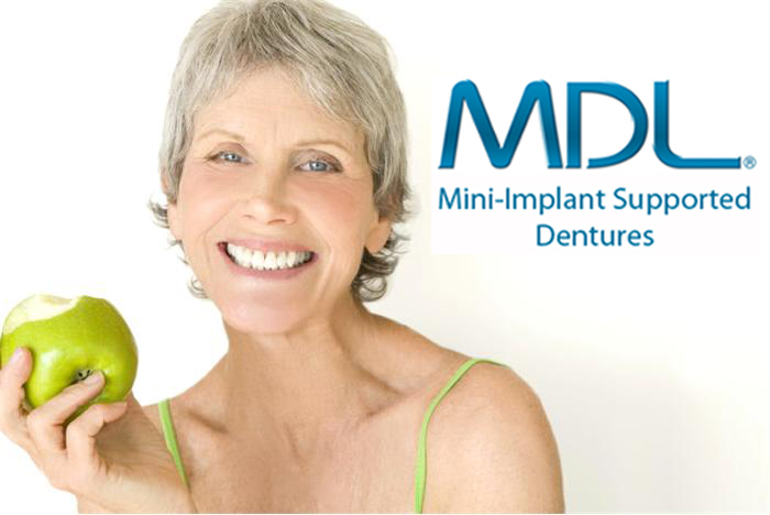 Mini Implant Supported Dentures