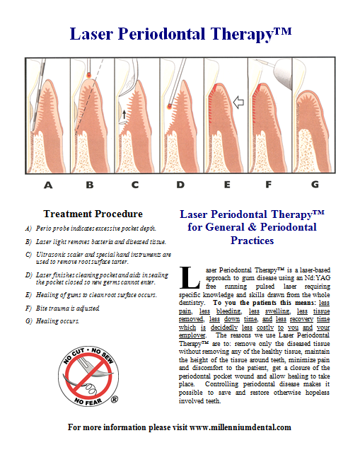 Laser Periodontal Therapy
