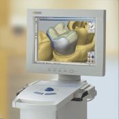 CEREC One Visit Dentistry
