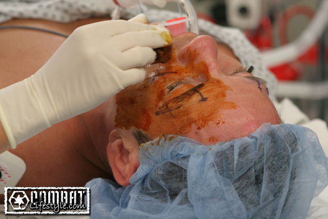 Eye Plastic Surgery