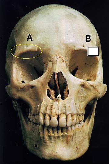 Facial Trauma Plastic Surgery