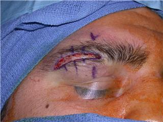 Facial Plastic Surgery