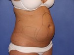 Dr. Rady Rahban, Beverly Hills Plastic Surgeon