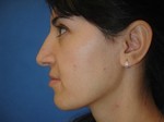 Dr. Rady Rahban, Beverly Hills Plastic Surgeon