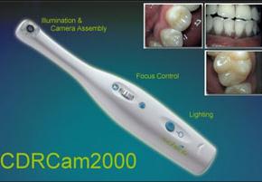 Intra Oral Camera