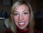 Case 54: Smile Rejuvination & Lumineers