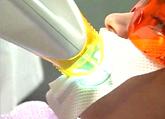 Zoom Teeth whitening