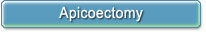 Apicoectomy