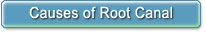 Causes of Root Canal