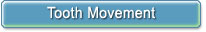 Tooth Movement