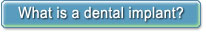 What is a dental implant?