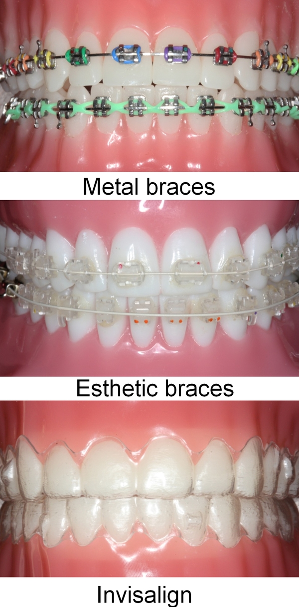 Odessa, TX Orthodontist Orthodontics Dental Solution, P.A.