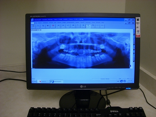 Dental Professionals in Harwood Heights offers patients Digital XRays