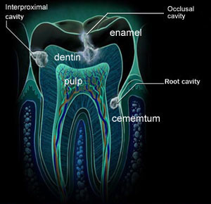 Tooth & Cavity diagram