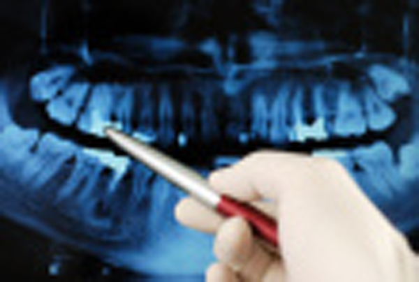 X-rays - Dr Jim Wright Cosmetic Dentist Las Vegas