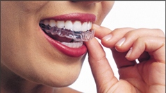 Invisalign Invisible Braces