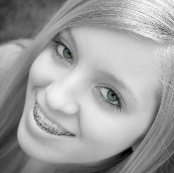 Malocclusions or crooked teeth can be caused by thumb-sucking as a child, mouth breathing, dental disease, abnormal swallowing, poor dental hygiene, the early or late loss of babyteeth and accidents