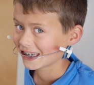Teeth Braces