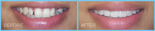 Humble Dentist Smile Enhancement