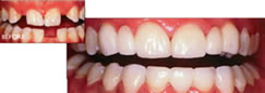 Dr. Michael Wilson, East Valley Dental