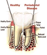 Dr. Michael Wilson, East Valley Dental