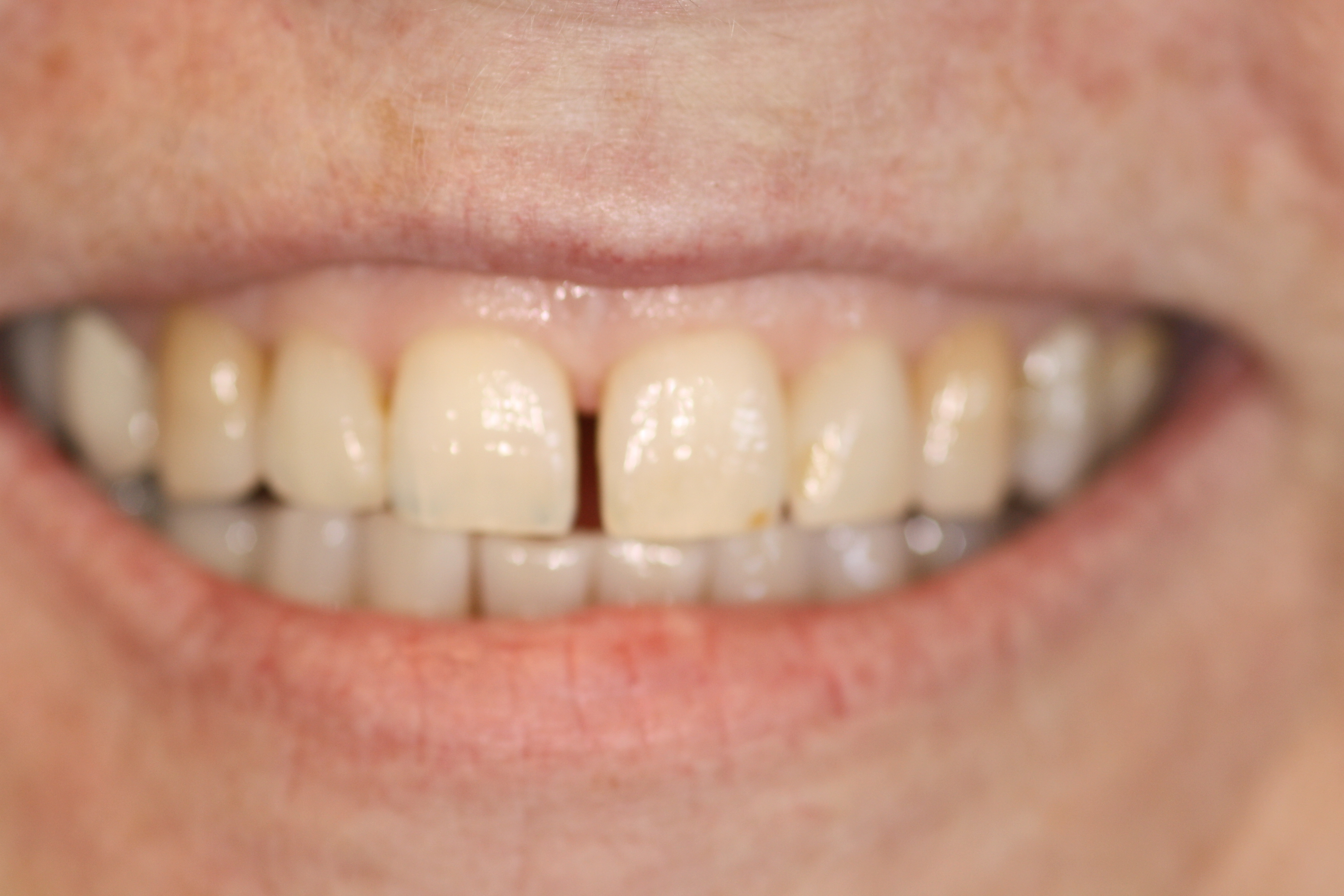 Smile Gallery Fair Oaks, CA Dr. Brian Orcutt