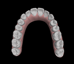 Palo Alto Invisalign Dentist - Christine E. Hansen, DDS