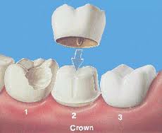 San Francisco Cosmetic Dentists