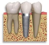 San Francisco Cosmetic Dentists