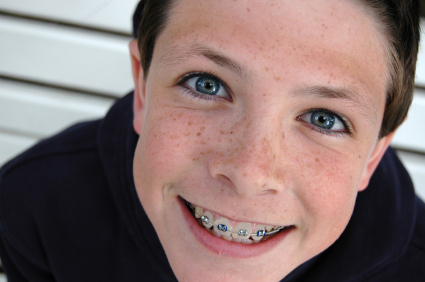 benefits of orthodontics