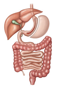 Gastric Sleeve in body