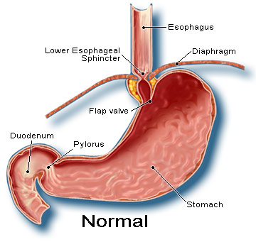 Hiatal Hernia - Normal