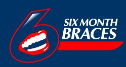 Six Month Braces, Dublin Dentist