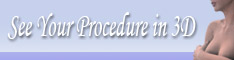 View your procedure in 3D