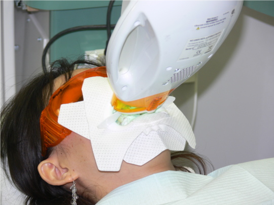 Tooth Whitening dentist, tooth whitening cosmetic, tooth bleaching, lighter teeth, Zoom, Los Angeles Dentist, quality dental care, Beverly Hills dentist, Los Angeles dentist, Hollywood dentist, whiter teeth, bright clean teeth, Zoom Whitening,