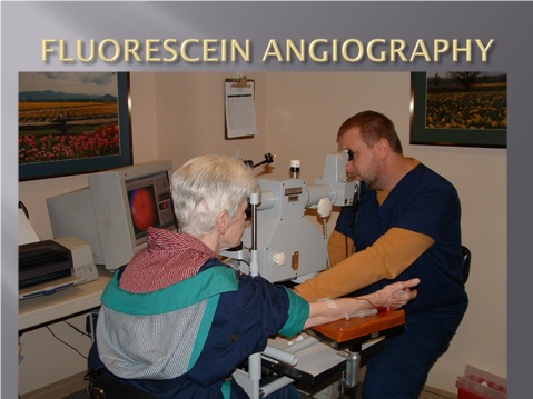 Fluorescein Angiography Test