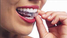 Saddleback Dentistry - Invisalign - Dr. Garcia - Dr. Conkle