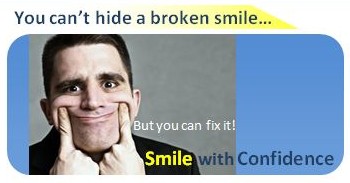 broken smile, fix smile, smile