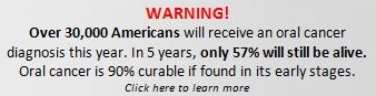 Vizilite, oral cancer