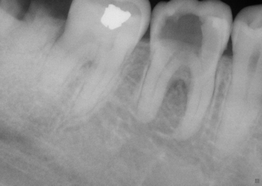 Dr. Brad Dilling provides cosmetic dentistry to patients near Fort Myers