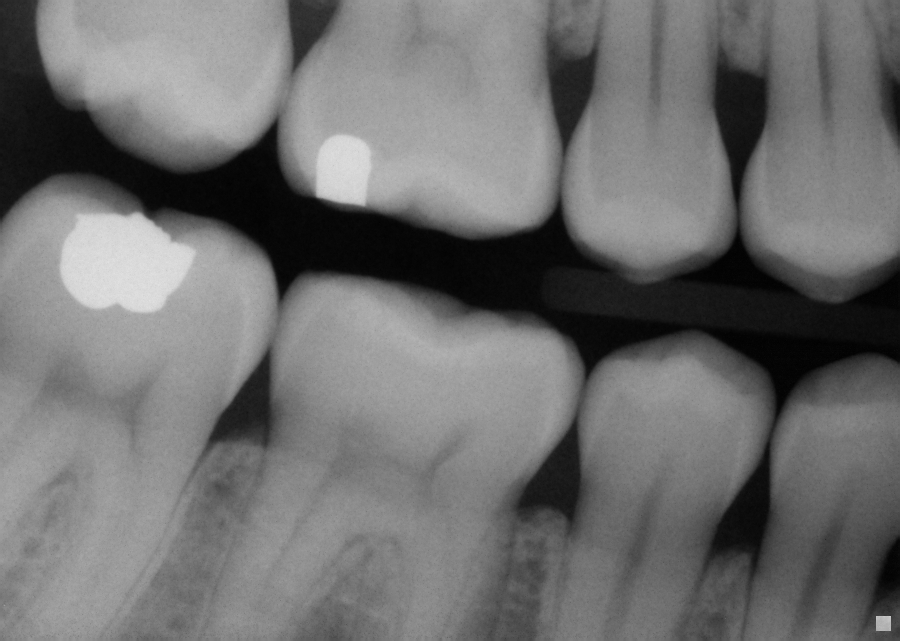 Dental Technology is an important aspect of Avalon Dental