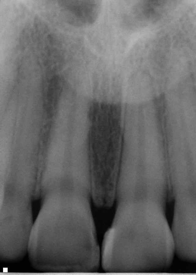 Avalon Dental utilizes the latest in dental technology
