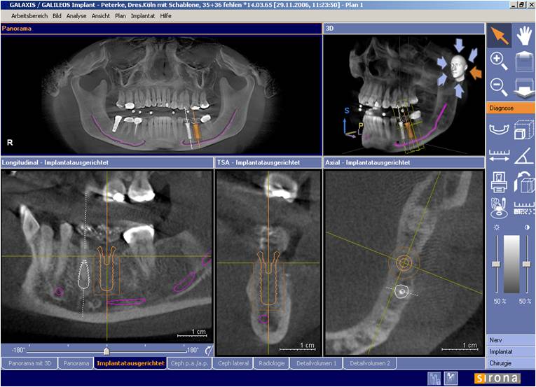dental cbct