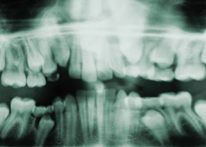 Laguna Niguel Dental Exams & Xrays