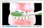 Dental Videos