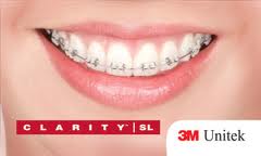Clarity | SL Orthodontic Brackets