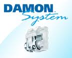 Damon System Brackets