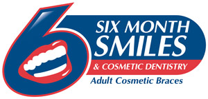 Six Month Smiles - Cosmetic Braces offered at Plaza Health Dentistry
